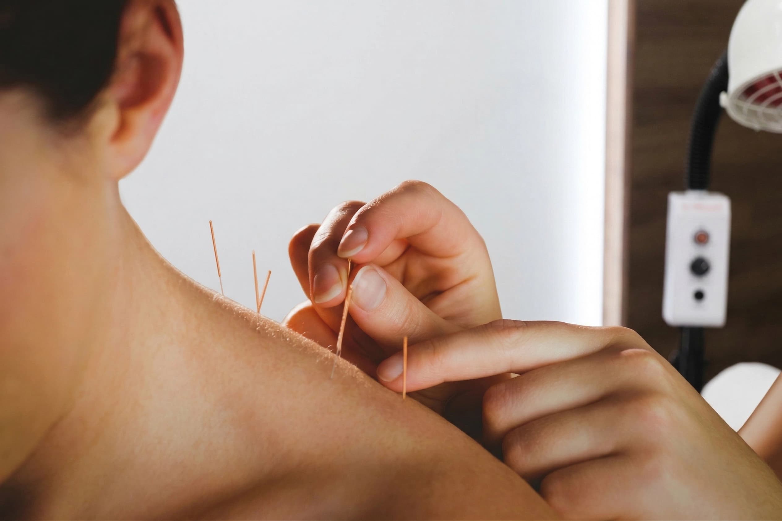 Acupuncture & Hijama